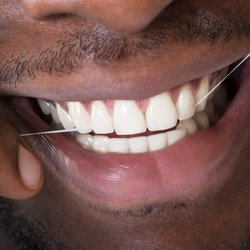 Alaa AlWazzan, DMD, PC - Smile wider with dental veneers. These thin dental laminates are placed on the front of your teeth...