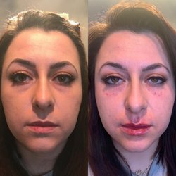 Timeless Aesthetic Injections