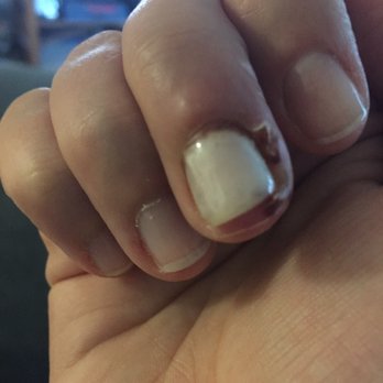 Posh Nail Spa - 4 days after my visit that landed me in urgent care and then the ER. - Nail Salons Near Me - Nashua, New Hampshire Posh Nail Spa - 4 days after my visit that landed me in urgent care and then the ER. - Nail Salons Near Me - Nashua, New Hampshire