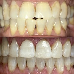 Solay Dental - Solay Dental
3144 Tampa Rd #3,
Oldsmar, FL 34677
https://www.solaydental.com/
