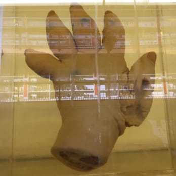 Barts Pathology Museum - An elephantitus hand. - Museums Near Me - West Smithfield, XGL