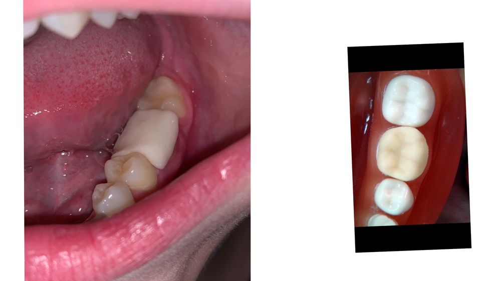 GREENBERG DENTAL Updated September 2024 11 Reviews 3131 SW