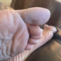 Bottom of foot Bottom of foot