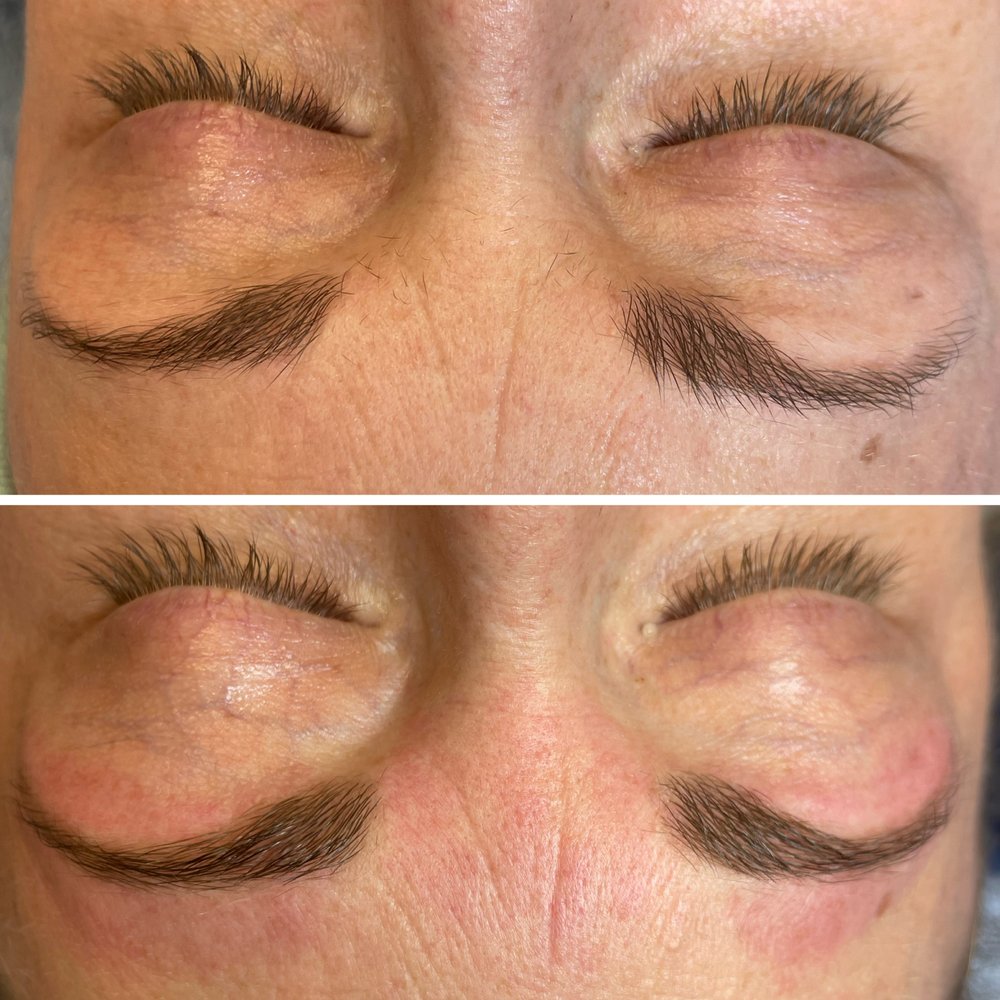 ELEMENT ESTHETICS Request an Appointment 22 Photos Fort Wayne