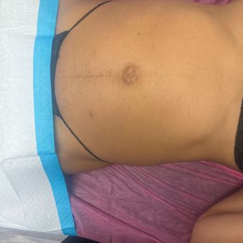 Magda Luxe - Lymphatic massage - Body Contouring Near Me
