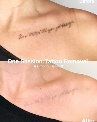 Simon Ourian, MD by null