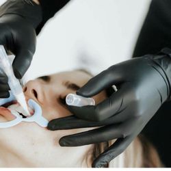 TotalBright Teeth Whitening