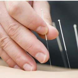 Chang Acupuncture & Herbology