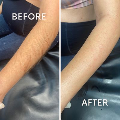 Legs & Arms - Whether you need a full-body wax or a quick touch up, we are here to achieve your goals with our skilled esthetician, Alexis, that uses gentle techniques and high quality products. Call or visit website to book today!