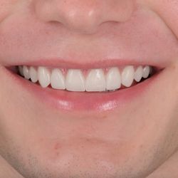Stone Oak Aesthetic Dentistry