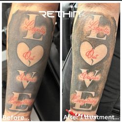 Rethink - Before and After 1 treatment