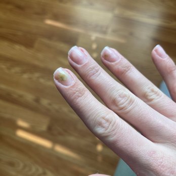 Creative Nails & Spa - Fungus developed under my nails from only two months of receiving dip powder here. - Nail Salons Near Me - Branford, Connecticut Creative Nails & Spa - Fungus developed under my nails from only two months of receiving dip powder here. - Nail Salons Near Me - Branford, Connecticut
