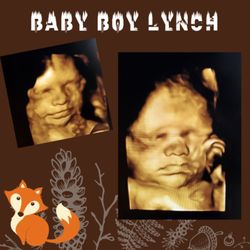 Sneak Peek Keepsake Ultrasound