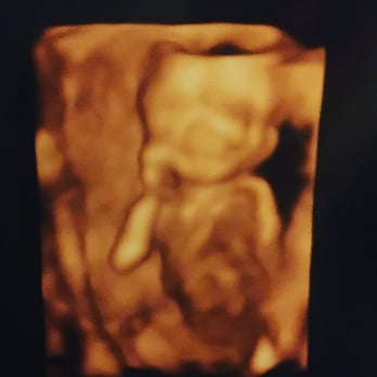 4D Miracles - She got a pic of our baby boy smiling! - Ultrasound Imaging Centers Near Me - Fremont, California 4D Miracles - She got a pic of our baby boy smiling! - Ultrasound Imaging Centers Near Me - Fremont, California