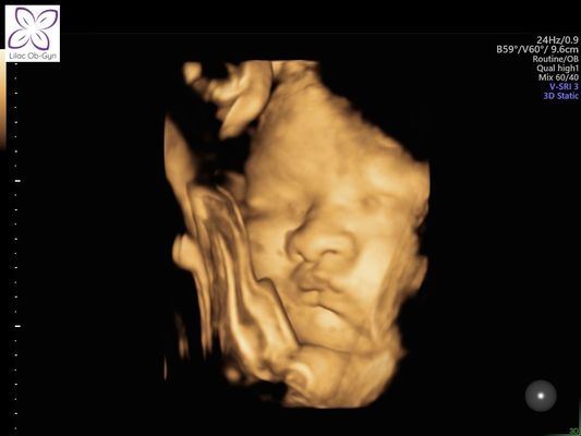 LILAC OB-GYN - Updated October 2025 - 115 Reviews - 655 S Dobson Rd ...