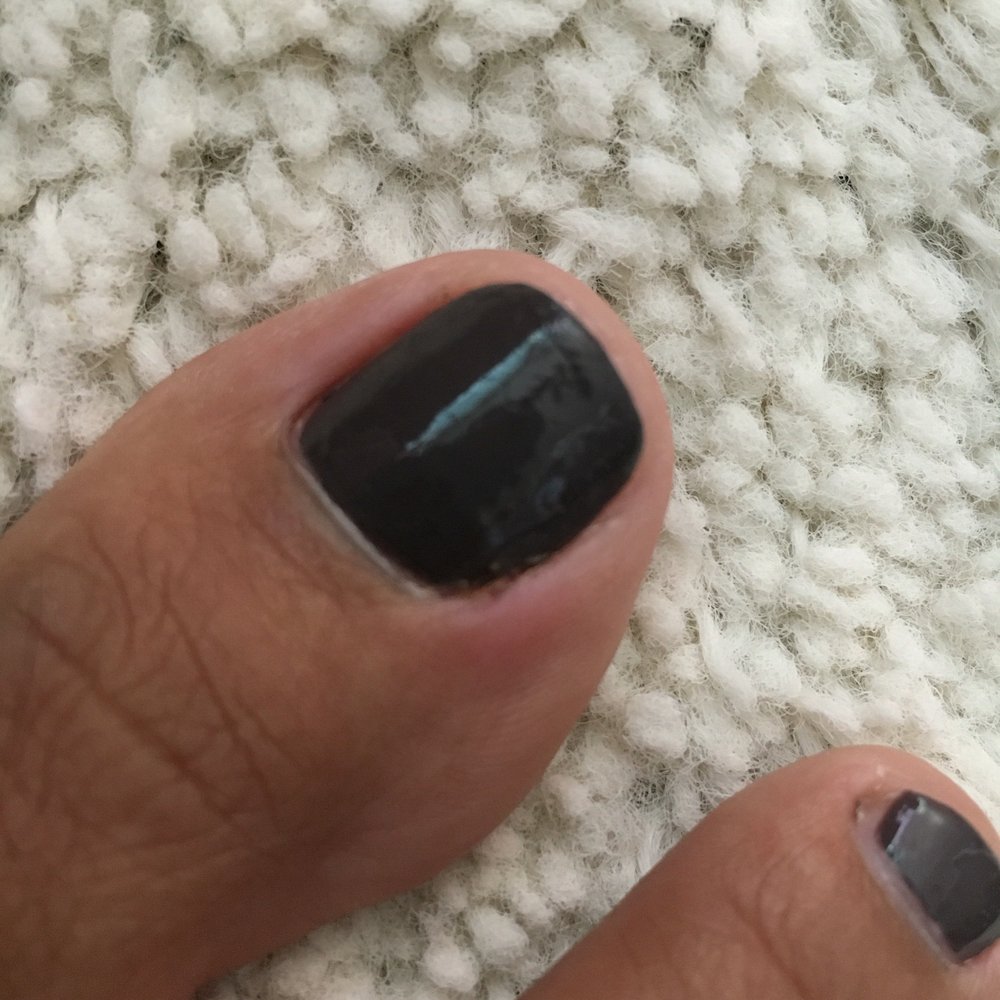 Forever Nails - The girl who did my nail did this...it hurts and I'm praying it won't get worst... - Nail Salons Near Me - Honolulu, Hawaii