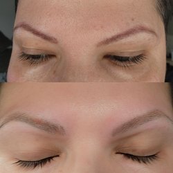 TattooMedics Laser Tattoo Removal - The top is before and the bottom is after.