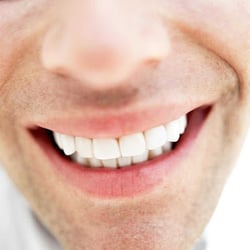 William Eickhoff Dentistry - Teeth Bleaching Service North Palm Beach FL