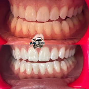 M’s Tooth Gems - Teeth Whitening Near Me - University Place, Washington M’s Tooth Gems - Teeth Whitening Near Me - University Place, Washington