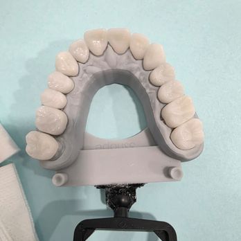 Pomona Dental Group - Beautiful Esthetic Durable Crowns - General Dentistry Near Me - Pomona, California Pomona Dental Group - Beautiful Esthetic Durable Crowns - General Dentistry Near Me - Pomona, California