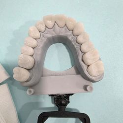 Pomona Dental Group - Beautiful Esthetic Durable Crowns
