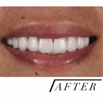 Vida Dentistry - Cosmetic Dentists Near Me - Mission Viejo, California Vida Dentistry - Cosmetic Dentists Near Me - Mission Viejo, California