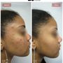 Photo of Derma Laser Centers