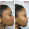 Derma Laser Centers gift card