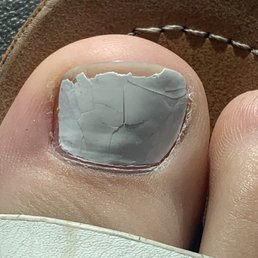 My right big toe My right big toe
