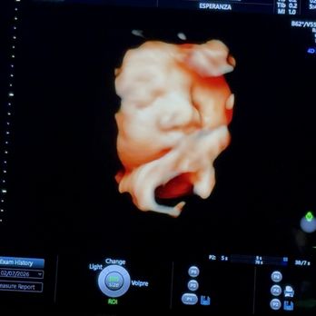 Unique Ultrasound - 4d scan at 39 weeks - Diagnostic Imaging Near Me - Temecula, California
