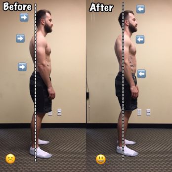Mana Recoup - Posture before and after. - Massage Therapy Near Me - San Diego, California Mana Recoup - Posture before and after. - Massage Therapy Near Me - San Diego, California