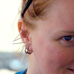 Acupuncture Pain Relief Centers Of Indiana - Ear Acupuncture