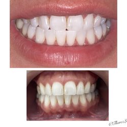 Beauty of Smile by Therez