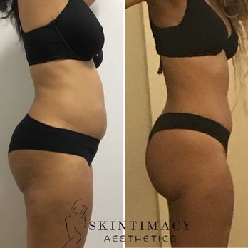 Skintimacy Aesthetics - Medical Spas Near Me - Los Angeles, California Skintimacy Aesthetics - Medical Spas Near Me - Los Angeles, California