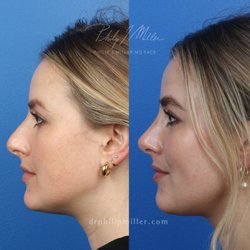 Before and after