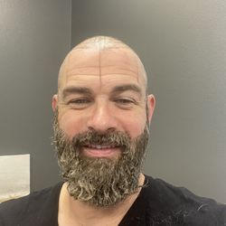Abrams Aesthetics And Hair Restoration - Shaved and ready!