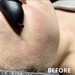 Kel Aesthetics - Before photo