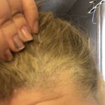 Diva's Beauty - Patch of missing hair. - Hair Salons Near Me - Cathedral City, California