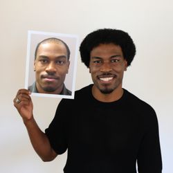 Bosley Hair Restoration & Transplant