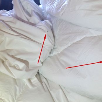 Skyland - Bed bugs were crawling all over our beds at 9 am in daylight. This is only three of around 60. - Resorts Near Me - Luray, Virginia