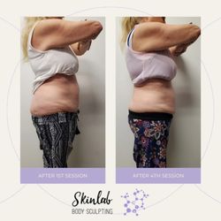 SkinLab Aesthetics - PROGRESS