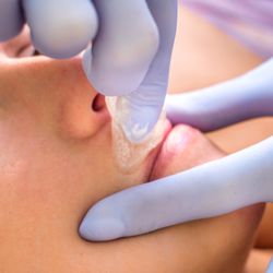 Pure Sugaring - Upper lip sugaring