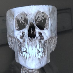 Senan Orthodontic Studios - Ever wonder what you or your child's skull looks like? Yea...me neither, but now I know! They have some cool technology!