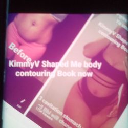 KimmyV Shaped Me body contouring