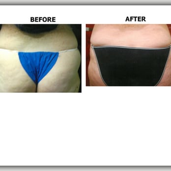 Joseph Fretta M.D - Body Contouring Near Me - Eatontown, New Jersey Joseph Fretta M.D - Body Contouring Near Me - Eatontown, New Jersey