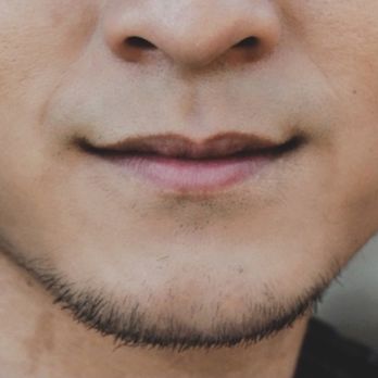 The Image Center - before: natural lip - Plastic Surgeons Near Me - Irvine, California