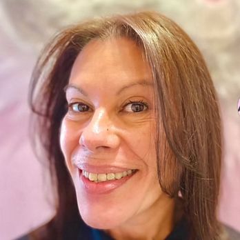VIP Glam Studio - After - Skin Care Near Me - Plantation, Florida