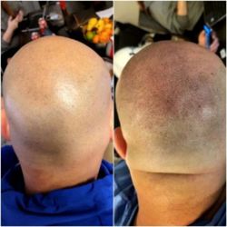 nYou Image Ink - Before/After