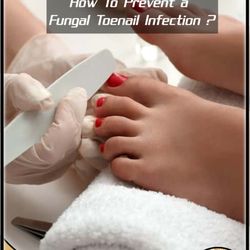 The following habits can help prevent nail fungus:Keep your nails clean and dry. Wash your hands and feet regularly.