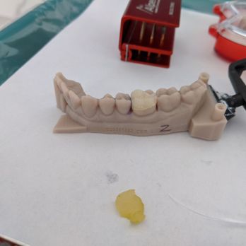 Smiles For Health - 3D printing super precise! - General Dentistry Near Me - Carlsbad, California Smiles For Health - 3D printing super precise! - General Dentistry Near Me - Carlsbad, California
